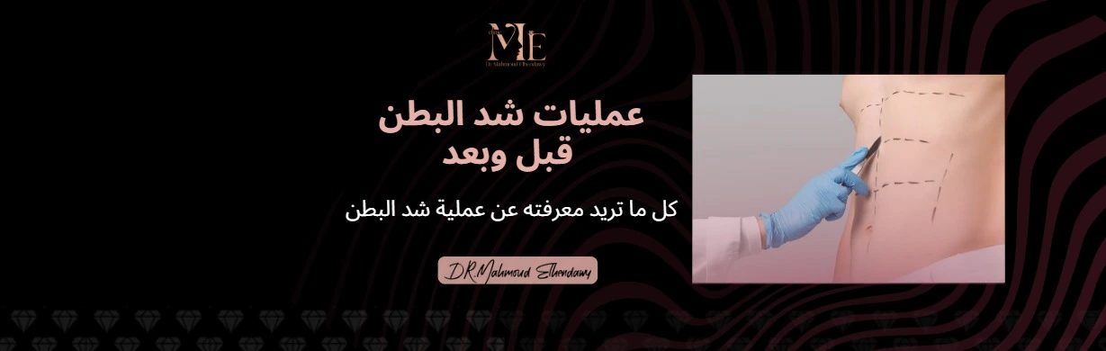 عمليات شد البطن قبل وبعد