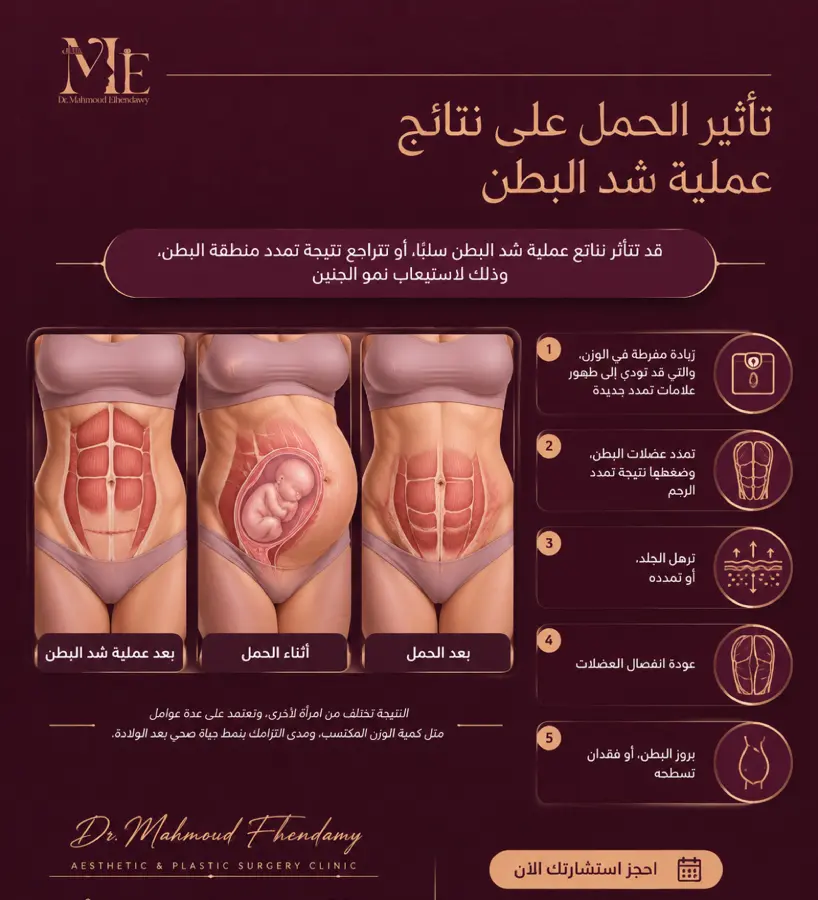 تأثير الحمل على نتائج عملية شد البطن