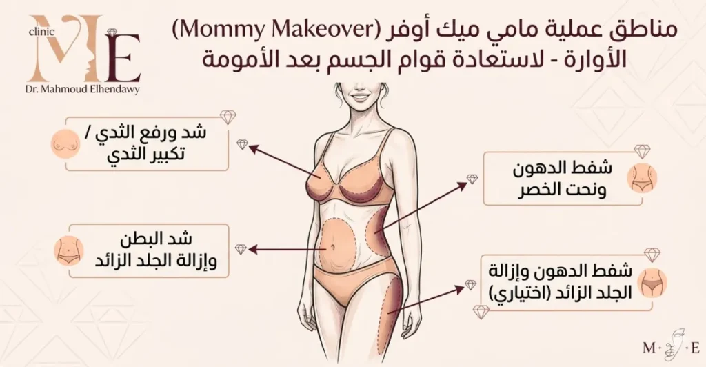 مامي ميك اوفر