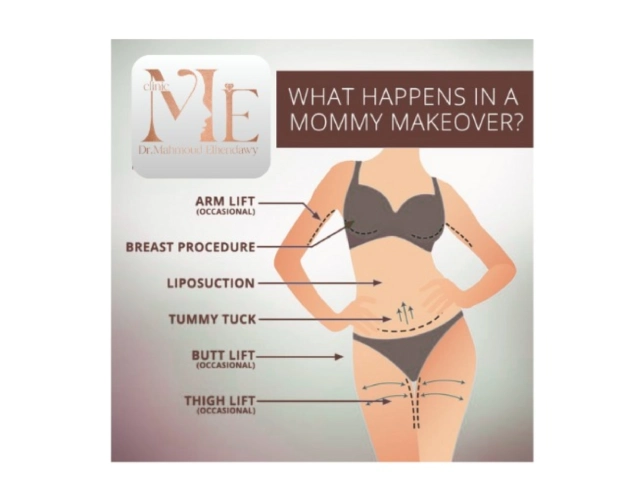 عملية مامي ميك اوفر