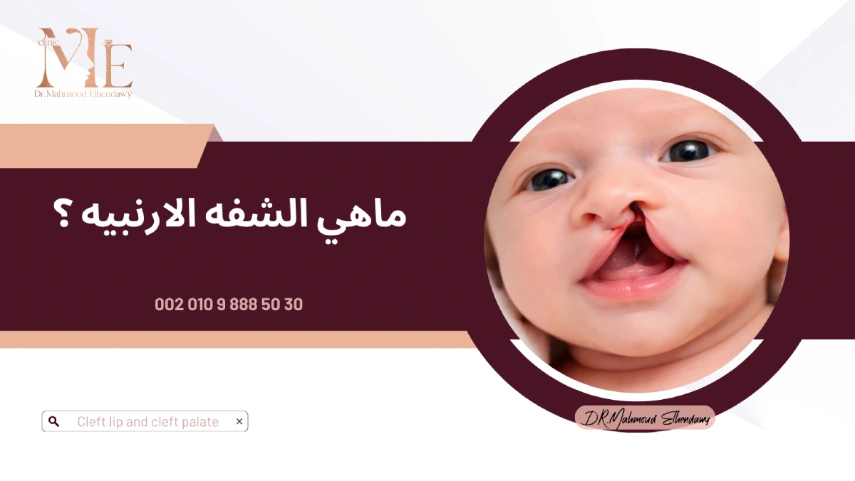 ماهي الشفه الارنبيه