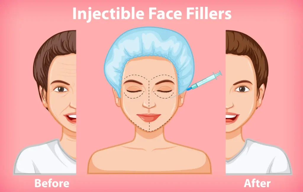 حقن الفيلر للوجه