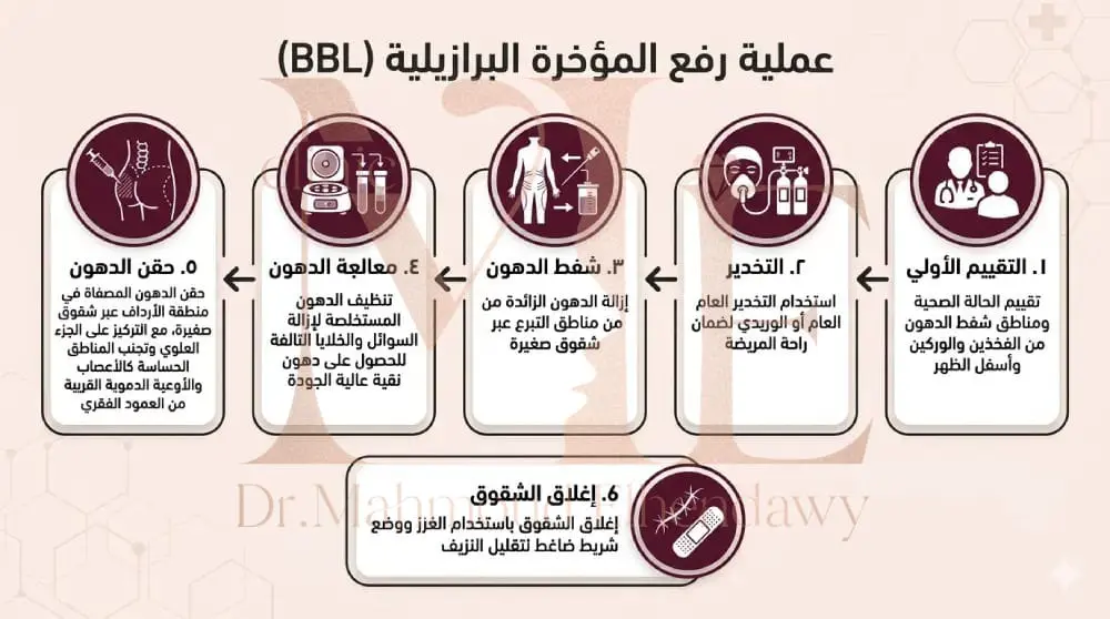 المؤخرة البرازيلية