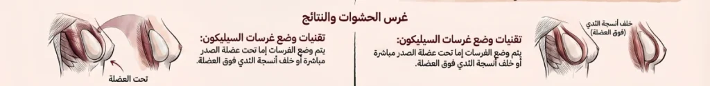 حشوات السيليكون للصدر