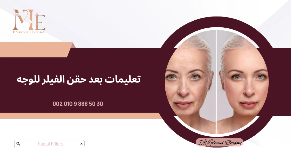 تعليمات بعد حقن الفيلر للوجه
