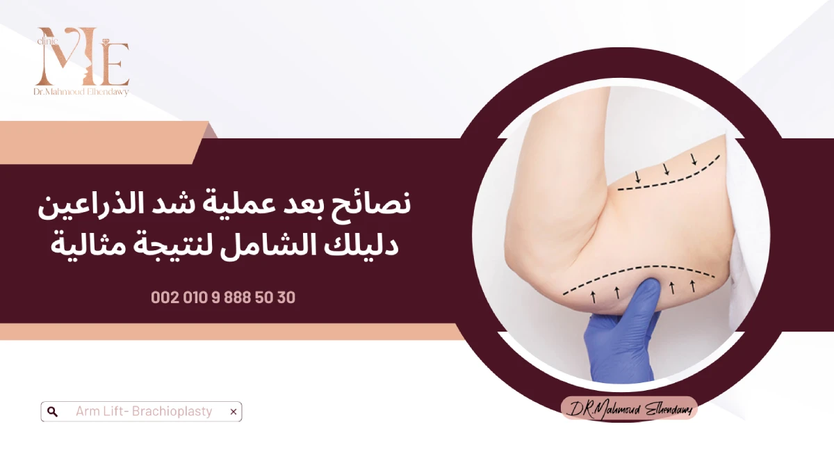 نصائح بعد عملية شد الذراعين