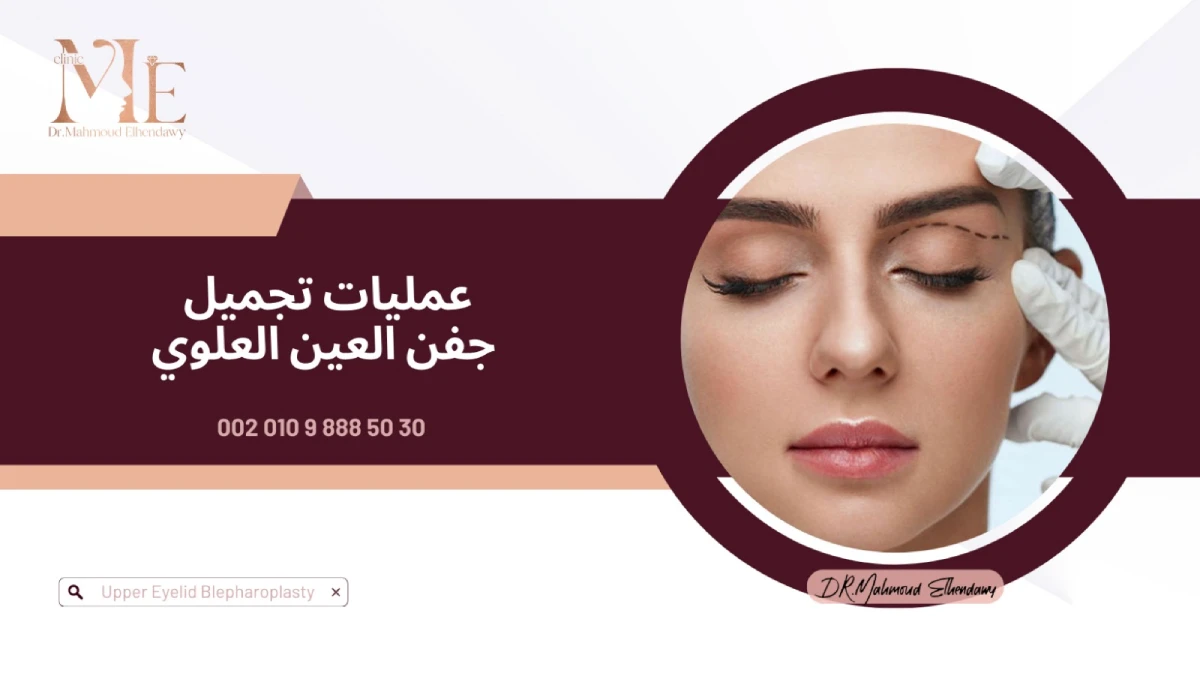 عمليات تجميل جفن العين العلوي