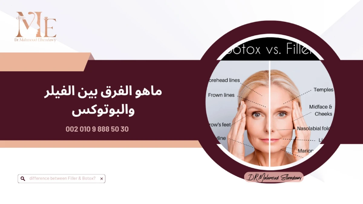 ما هو الفرق بين الفيلر والبوتوكس؟