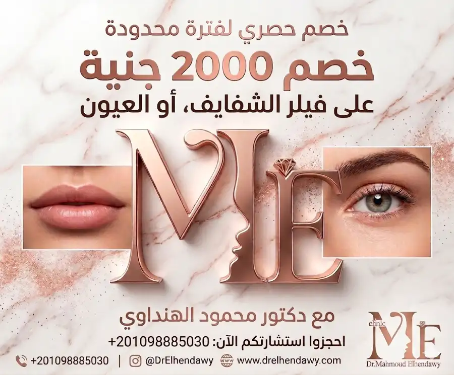 خصم الفيلر