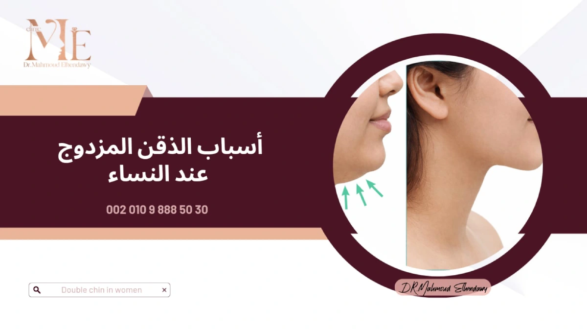 أسباب الذقن المزدوج عند النساء