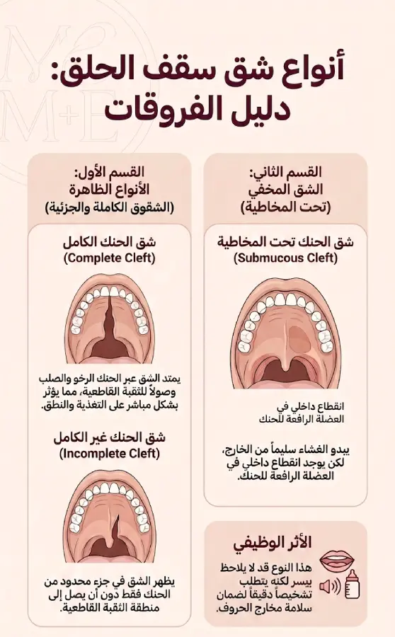 أنواع شق سقف الحلق