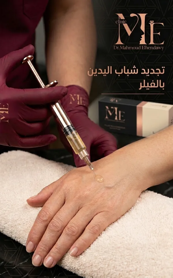 حقن اليدين بالفيلر