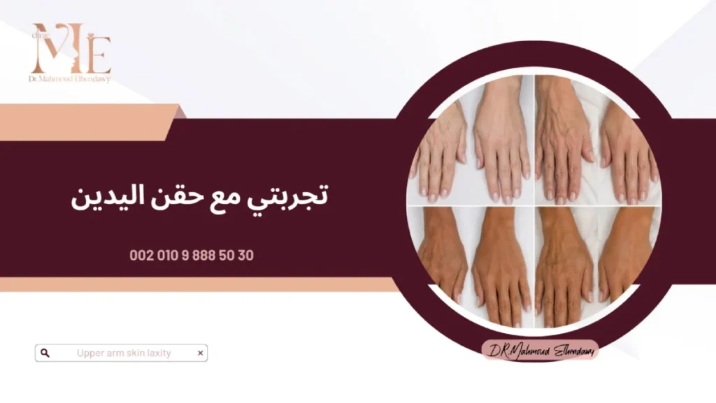 تجربتي مع حقن اليدين