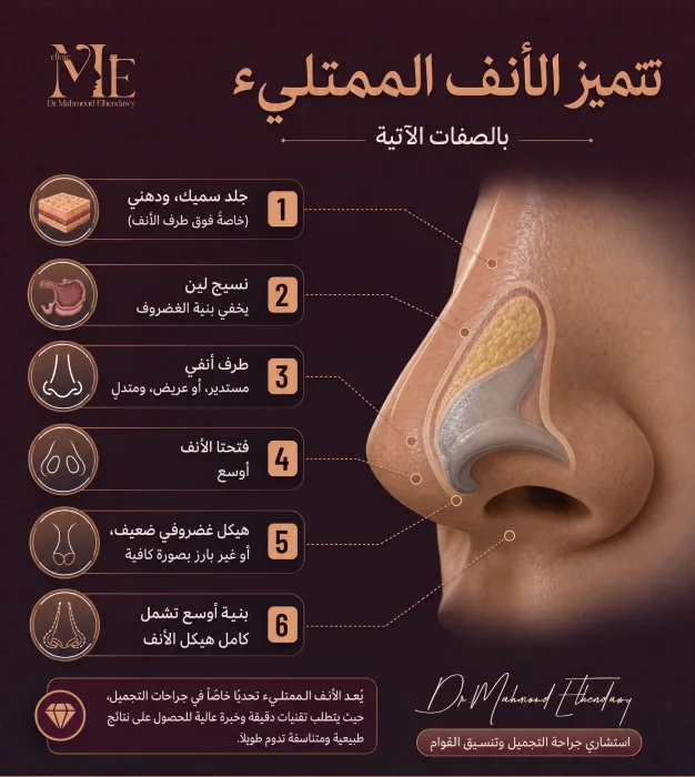 صفات الأنف اللحمي