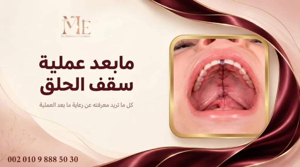 مابعد عملية سقف الحلق